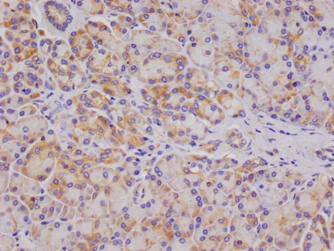 Immunohistochemistry: OS9 Antibody (26H3) [NBP3-26446] - Image of OS9 Antibody (26H3) diluted at 1:100 and staining in paraffin-embedded human pancreatic tissue performed. After dewaxing and hydration, antigen retrieval was mediated by high pressure in a citrate buffer (pH 6.0). Section was blocked with 10% normal goat serum 30min at RT. Then primary antibody (1% BSA) was incubated at 4°C overnight. The primary is detected by a Goat anti-rabbit polymer IgG labeled by HRP and visualized using 0.05% DAB.