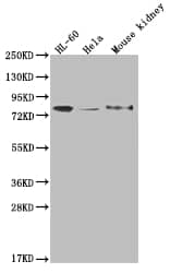 Western Blot: OS9 Antibody (26H3) [NBP3-26446] - Positive Western Blot detected in: HL-60 whole cell lysate, Hela whole cell lysate, Mouse kidney tissue. All lanes: OS9 Antibody at 1: 2000 Secondary: Goat polyclonal to rabbit IgG at 1/50000 dilution. Predicted band size: 76, 70, 68, 74, 66, 64, 70, 61 kDa Observed band size: 72-95 kDa