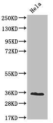 Western Blot: ADP-Sugar Pyrophosphatase/NUDT5 Antibody (10D2) [NBP3-26453] - Positive Western Blot detected in: Hela whole cell lysate. All lanes: ADP-Sugar Pyrophosphatase/NUDT5 Antibody at 1: 2000 Secondary: Goat polyclonal to rabbit IgG at 1/50000 dilution. Predicted band size: 25 kDa Observed band size: 36 kDa