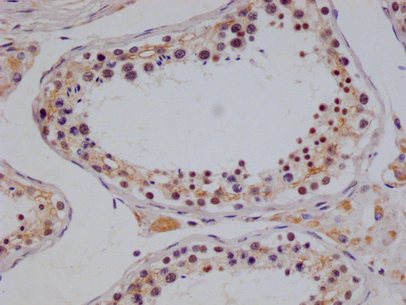 Immunohistochemistry: NTH1 Antibody (22H10) [NBP3-26456] - Image of NTH1 Antibody (22H10) diluted at 1:100 and staining in paraffin-embedded human testis tissue performed. After dewaxing and hydration, antigen retrieval was mediated by high pressure in a citrate buffer (pH 6.0). Section was blocked with 10% normal goat serum 30min at RT. Then primary antibody (1% BSA) was incubated at 4°C overnight. The primary is detected by a Goat anti-rabbit polymer IgG labeled by HRP and visualized using 0.05% DAB.