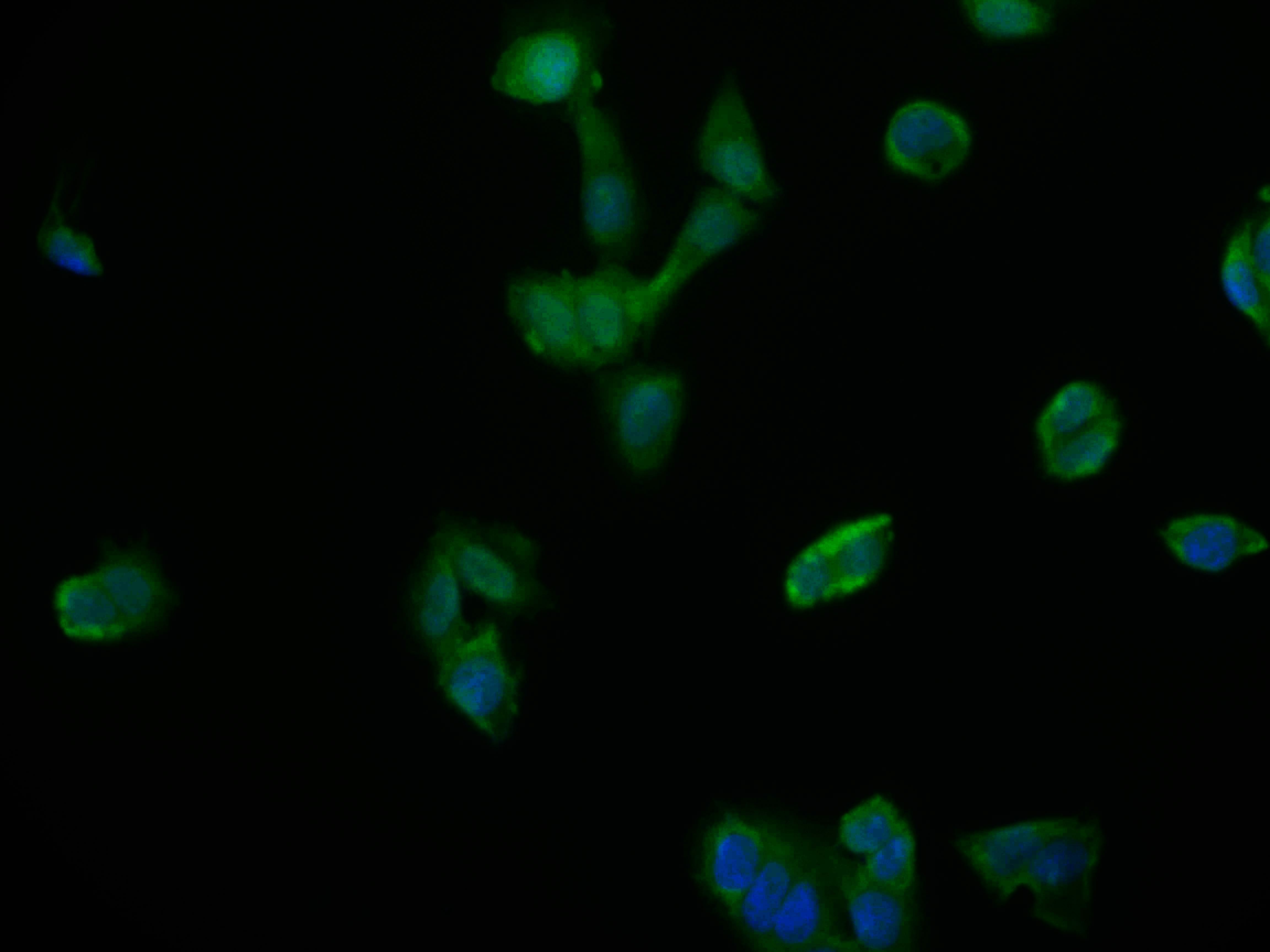 Immunocytochemistry/Immunofluorescence: NTH1 Antibody (22H10) [NBP3-26456] - Staining of PC-3 cell with NTH1 Antibody (22H10) at 1:50, counter-stained with DAPI. The cells were fixed in 4% formaldehyde and blocked in 10% normal Goat Serum. The cells were then incubated with the antibody overnight at 4C. The secondary antibody was Alexa Fluor 604-conjugated Goat Anti-Rabbit IgG (H+L).