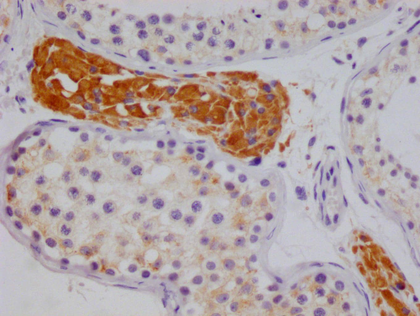 Immunohistochemistry: NSDHL Antibody (20F2) [NBP3-26457] - Image of NSDHL Antibody (20F2) diluted at 1:100 and staining in paraffin-embedded human testis tissue performed. After dewaxing and hydration, antigen retrieval was mediated by high pressure in a citrate buffer (pH 6.0). Section was blocked with 10% normal goat serum 30min at RT. Then primary antibody (1% BSA) was incubated at 4C overnight. The primary is detected by a Goat anti-rabbit polymer IgG labeled by HRP and visualized using 0.05% DAB.