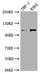 Western Blot: Complement C3 Antibody (4D12) [NBP3-26471] - Positive Western Blot detected in: THP-1 whole cell lysate, K562 whole cell lysate. All lanes: Complement C3 Antibody at 1: 1000 Secondary: Goat polyclonal to rabbit IgG at 1/50000 dilution. Predicted band size: 188 kDa Observed band size: 115 kDa