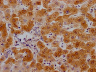 Immunohistochemistry: Complement C3 Antibody (8C3) [NBP3-26472] - Image of Complement C3 Antibody (8C3) diluted at 1:100 and staining in paraffin-embedded human liver tissue performed. After dewaxing and hydration, antigen retrieval was mediated by high pressure in a citrate buffer (pH 6.0). Section was blocked with 10% normal goat serum 30min at RT. Then primary antibody (1% BSA) was incubated at 4C overnight. The primary is detected by a Goat anti-rabbit IgG polymer labeled by HRP and visualized using 0.05% DAB.