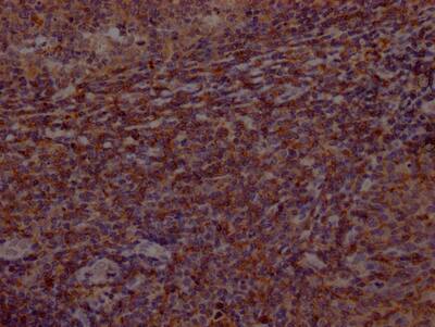 Immunohistochemistry: BTK Antibody (3E5) [NBP3-26473] - Image of BTK Antibody (3E5) diluted at 1:100 and staining in paraffin-embedded human tonsil tissue performed. After dewaxing and hydration, antigen retrieval was mediated by high pressure in a citrate buffer (pH 6.0). Section was blocked with 10% normal goat serum 30min at RT. Then primary antibody (1% BSA) was incubated at 4C overnight. The primary is detected by a Goat anti-rabbit IgG polymer labeled by HRP and visualized using 0.05% DAB.