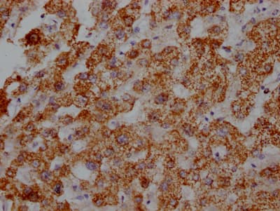 Immunohistochemistry: ATPB Antibody (5F10) [NBP3-26490] - Image of ATPB Antibody (5F10) diluted at 1:100 and staining in paraffin-embedded human heart tissue performed. After dewaxing and hydration, antigen retrieval was mediated by high pressure in a citrate buffer (pH 6.0). Section was blocked with 10% normal goat serum 30min at RT. Then primary antibody (1% BSA) was incubated at 4C overnight. The primary is detected by a Goat anti-rabbit IgG polymer labeled by HRP and visualized using 0.05% DAB.