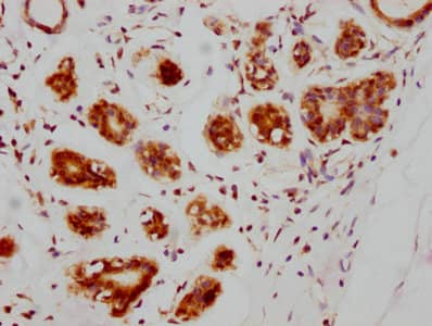 Immunohistochemistry: ATM Antibody (4E11) [NBP3-26493] - Image of ATM Antibody (4E11) diluted at 1:205 and staining in paraffin-embedded human testis tissue performed. After dewaxing and hydration, antigen retrieval was mediated by high pressure in a citrate buffer (pH 6.0). Section was blocked with 10% normal goat serum 30min at RT. Then primary antibody (1% BSA) was incubated at 4C overnight. The primary is detected by a biotinylated secondary antibody and visualized using an HRP conjugated SP system.