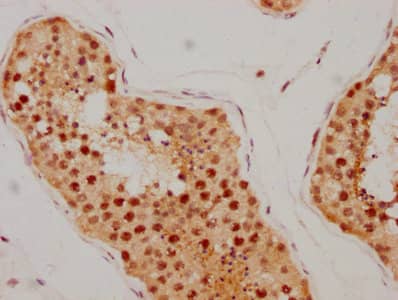 Immunohistochemistry: ATM Antibody (4E11) [NBP3-26493] - Image of ATM Antibody (4E11) diluted at 1:205 and staining in paraffin-embedded human testis tissue performed. After dewaxing and hydration, antigen retrieval was mediated by high pressure in a citrate buffer (pH 6.0). Section was blocked with 10% normal goat serum 30min at RT. Then primary antibody (1% BSA) was incubated at 4C overnight. The primary is detected by a biotinylated secondary antibody and visualized using an HRP conjugated SP system.