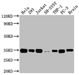 Western Blot: ATF5 Antibody (9D8) [NBP3-26496] - Positive Western Blot detected in: Hela whole cell lysate, 293 whole cell lysate, Jurkat whole cell lysate, SH-SY5Y whole cell lysate, THP-1 whole cell lysate, PC-3 whole cell lysate, Rat brain tissue. All lanes: ATF5 Antibody at 1: 2000 Secondary: Goat polyclonal to rabbit IgG at 1/50000 dilution. Predicted band size: 31 kDa Observed band size: 35 kDa