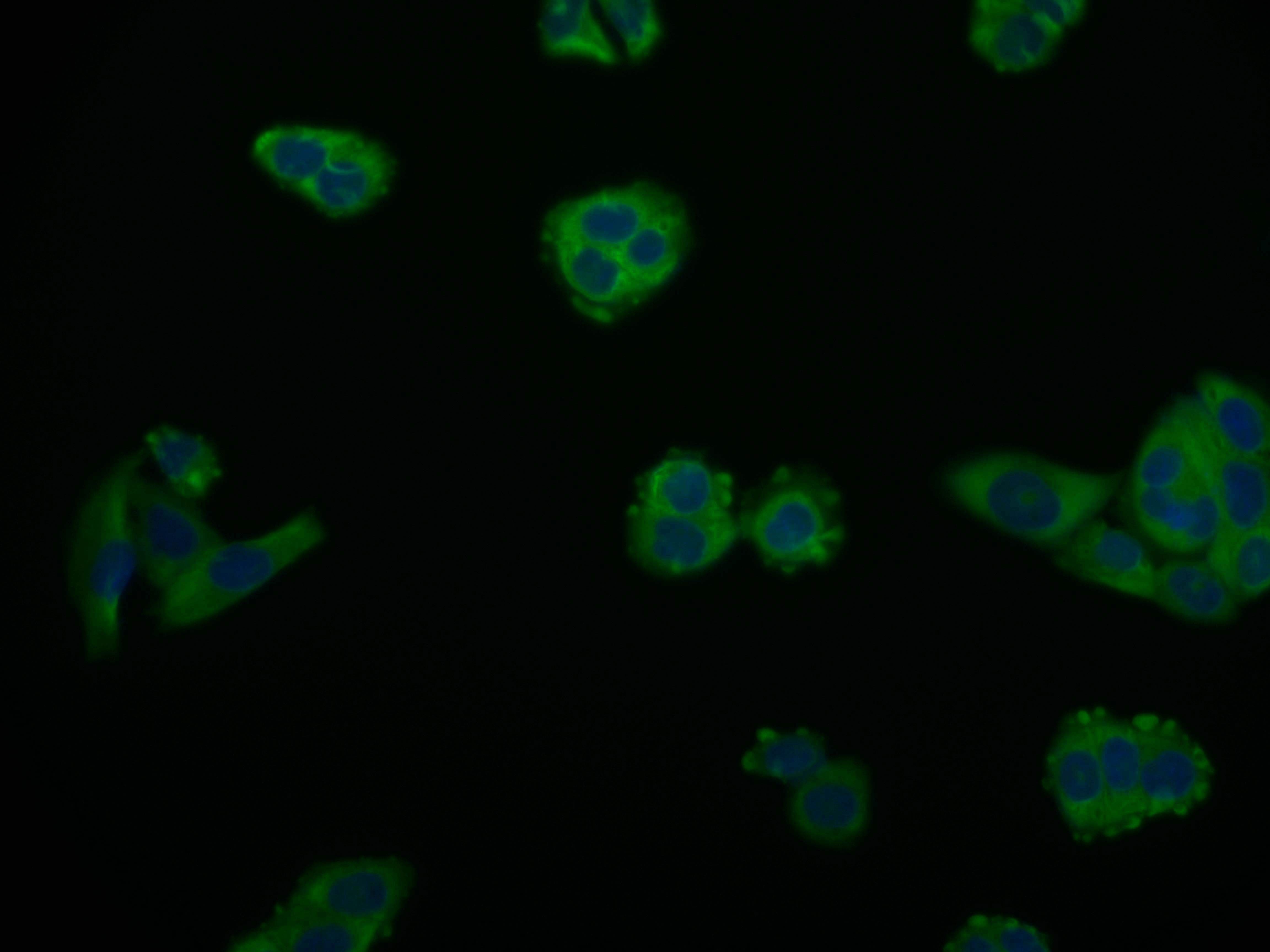 Immunocytochemistry/Immunofluorescence: ARG2 Antibody (9A4) [NBP3-26500] - Staining of PC-3 cell with ARG2 Antibody (9A4) at 1:50, counter-stained with DAPI. The cells were fixed in 4% formaldehyde and blocked in 10% normal Goat Serum. The cells were then incubated with the antibody overnight at 4C. The secondary antibody was Alexa Fluor 559-conjugated Goat Anti-Rabbit IgG (H+L).