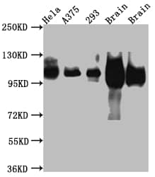 Western Blot: APP Antibody (6F10) [NBP3-26502] - Positive Western Blot detected in: Hela whole cell lysate, A375 whole cell lysate, HEK293 whole cell lysate, Rat Brain whole cell lysate, Mouse Brain whole cell lysate. All lanes: APP Antibody at 1: 1000 Secondary: Goat polyclonal to rabbit IgG at 1/50000 dilution. Predicted band size: 87, 35, 77, 79, 79, 81, 83, 85, 86, 73, 85 kDa Observed band size: 100 kDa