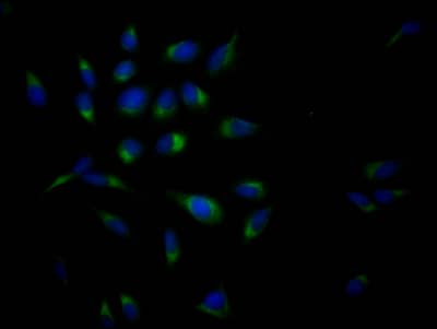 Immunocytochemistry/Immunofluorescence: APP Antibody (6F10) [NBP3-26502] - Staining of Hela Cells with APP Antibody (6F10) at 1:50, counter-stained with DAPI. The cells were fixed in 4% formaldehyde, permeated by 0.2% Triton X-100, and blocked in 10% normal Goat Serum. The cells were then incubated with the antibody overnight at 4C. Nuclear DNA was labeled in blue with DAPI. The secondary antibody was FITC-conjugated Goat Anti-Rabbit IgG (H+L).