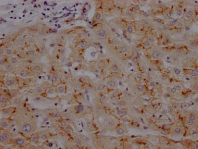 Immunohistochemistry: Aminopeptidase N/CD13 Antibody (6E9) [NBP3-26507] - Image of Aminopeptidase N/CD13 Antibody (6E9) diluted at 1:100 and staining in paraffin-embedded human liver tissue performed. After dewaxing and hydration, antigen retrieval was mediated by high pressure in a citrate buffer (pH 6.0). Section was blocked with 10% normal goat serum 30min at RT. Then primary antibody (1% BSA) was incubated at 4C overnight. The primary is detected by a Goat anti-rabbit IgG polymer labeled by HRP and visualized using 0.05% DAB.