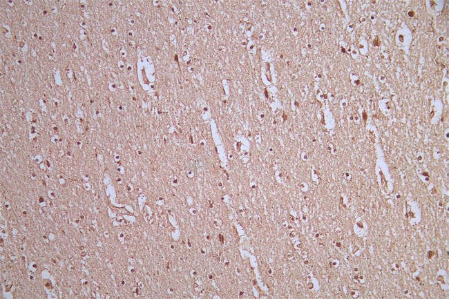 Immunohistochemistry: AKT1/2/3 Antibody (16E10) [NBP3-26514] - Image of AKT1/2/3 Antibody (16E10) diluted at 1:50 and staining in paraffin-embedded human brain tissue performed. After dewaxing and hydration, antigen retrieval was mediated by high pressure in a citrate buffer (pH 6.0). Section was blocked with 10% normal goat serum 30min at RT. Then primary antibody (1% BSA) was incubated at 4°C overnight. The primary is detected by a Goat anti-rabbit polymer IgG labeled by HRP and visualized using 0.54% DAB.