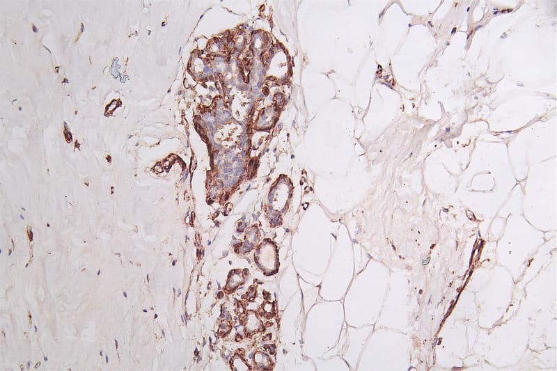 Immunohistochemistry: Actin Antibody (4C1) [NBP3-26526] - Image of Actin Antibody diluted at 1:50 and staining in paraffin-embedded human skeletal muscle tissue performed. After dewaxing and hydration, antigen retrieval was mediated by high pressure in a citrate buffer (pH 6.0). Section was blocked with 10% normal goat serum 30min at RT. Then primary antibody (1% BSA) was incubated at 4C overnight. The primary is detected by a Goat anti-rabbit polymer IgG labeled by HRP and visualized using 0.72% DAB.