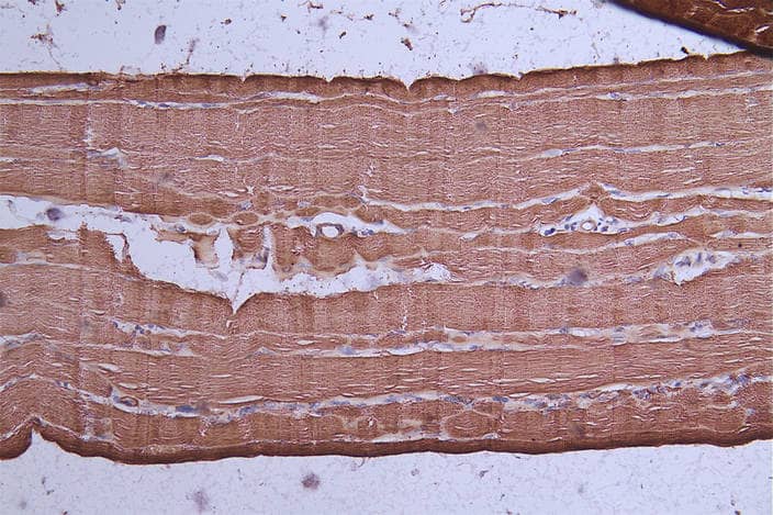 Immunohistochemistry: Actin Antibody (4C1) [NBP3-26526] - Image of Actin Antibody diluted at 1:50 and staining in paraffin-embedded human skeletal muscle tissue performed. After dewaxing and hydration, antigen retrieval was mediated by high pressure in a citrate buffer (pH 6.0). Section was blocked with 10% normal goat serum 30min at RT. Then primary antibody (1% BSA) was incubated at 4°C overnight. The primary is detected by a Goat anti-rabbit polymer IgG labeled by HRP and visualized using 0.72% DAB.