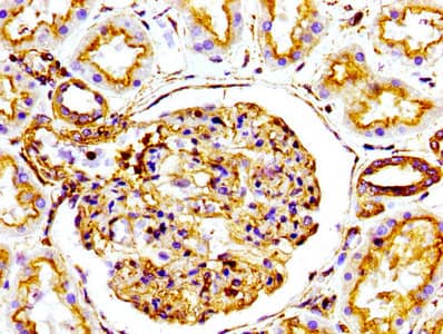 Immunohistochemistry: Actin Antibody (25E3) [NBP3-26527] - Image of Actin Antibody (25E3) diluted at 1:100 and staining in paraffin-embedded human kidney tissue performed. After dewaxing and hydration, antigen retrieval was mediated by high pressure in a citrate buffer (pH 6.0). Section was blocked with 10% normal goat serum 30min at RT. Then primary antibody (1% BSA) was incubated at 4C overnight. The primary is detected by a biotinylated secondary antibody and visualized using an HRP conjugated SP system.