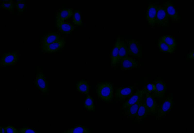 Immunocytochemistry/Immunofluorescence: Gelsolin/GSN Antibody (16H9) [NBP3-26541] - Staining of HepG2 with Gelsolin/GSN Antibody (16H9) at 1:50, counter-stained with DAPI. The cells were fixed in 4% formaldehyde and blocked in 10% normal Goat Serum. The cells were then incubated with the antibody overnight at 4C. The secondary antibody was Alexa Fluor 510-conjugated Goat Anti-Rabbit IgG (H+L).