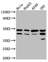 Western Blot: GSK-3 beta Antibody (9G11) [NBP3-26542] - Positive Western Blot detected in: Hela whole cell lysate, HepG2 whole cell lysate, A549 whole cell lysate, 293 whole cell lysate. All lanes: GSK3 beta Antibody at 1: 1000 Secondary: Goat polyclonal to rabbit IgG at 1/50000 dilution. Predicted band size: 47, 49 kDa Observed band size: 47 kDa