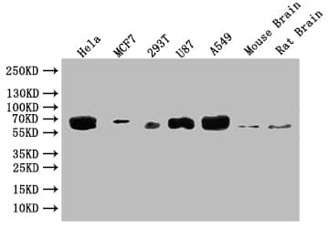 Western Blot: Glucosylceramidase/GBA Antibody (4H4) [NBP3-26559] - Positive Western Blot detected in: Hela whole cell lysate, MCF-7 whole cell lysate, 293T whole cell lysate, U87 whole cell lysate. All lanes: Glucosylceramidase/GBA Antibody at 1: 2000 Secondary: Goat polyclonal to rabbit IgG at 1/50000 dilution. Predicted band size: 60, 58, 55, 51, 30 kDa Observed band size: 60 kDa