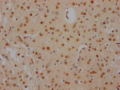 Immunohistochemistry: FUBP1 Antibody (7C3) [NBP3-26564] - Image of FUBP1 Antibody (7C3) diluted at 1:100 and staining in paraffin-embedded human brain tissue performed. After dewaxing and hydration, antigen retrieval was mediated by high pressure in a citrate buffer (pH 6.0). Section was blocked with 10% normal goat serum 30min at RT. Then primary antibody (1% BSA) was incubated at 4C overnight. The primary is detected by a Goat anti-rabbit IgG polymer labeled by HRP and visualized using 0.05% DAB.