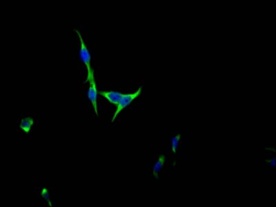 Immunocytochemistry/Immunofluorescence: FGFR3 Antibody (5B6) [NBP3-26581] - Staining of HepG2 Cells with FGFR3 Antibody (5B6) at 1:50, counter-stained with DAPI. The cells were fixed in 4% formaldehyde, permeated by 0.2% Triton X-100, and blocked in 10% normal Goat Serum. The cells were then incubated with the antibody overnight at 4C. Nuclear DNA was labeled in blue with DAPI. The secondary antibody was FITC-conjugated Goat Anti-Rabbit IgG (H+L).