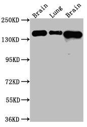 Western Blot: FGFR2 Antibody (2E9) [NBP3-26583] - Positive Western Blot detected in: Rat Brain whole cell lysate, Rat Lung whole cell lysate, Mouse Brain whole cell lysate. All lanes: FGFR2 Antibody at 1: 1000 Secondary: Goat polyclonal to rabbit IgG at 1/50000 dilution. Predicted band size: 93, 87, 93, 77, 92, 89, 86, 29, 80, 93, 97, 92, 41, 80, 80, 77, 80 kDa Observed band size: 145 kDa