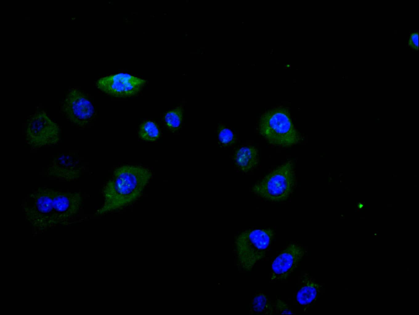 Immunocytochemistry/Immunofluorescence: Fc gamma RIIIA/CD16a Antibody (28C11) [NBP3-26586] - Staining of Hela cell with Fc gamma RIIIA/CD16a Antibody (28C11) at 1:30, counter-stained with DAPI. The cells were fixed in 4% formaldehyde and blocked in 10% normal Goat Serum. The cells were then incubated with the antibody overnight at 4C. The secondary antibody was Alexa Fluor 488-conjugated Goat Anti-Rabbit IgG (H+L).