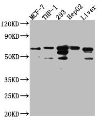 Western Blot: FAAH Antibody (8G3) [NBP3-26592] - Positive Western Blot detected in: MCF-7 whole cell lysate, THP-1 whole cell lysate, 293 whole cell lysate, HepG2 whole cell lysate, Mouse Liver whole cell lysate. All lanes: FAAH1 Antibody at 1: 1000 Secondary: Goat polyclonal to rabbit IgG at 1/50000 dilution. Predicted band size: 64 kDa Observed band size: 64 kDa