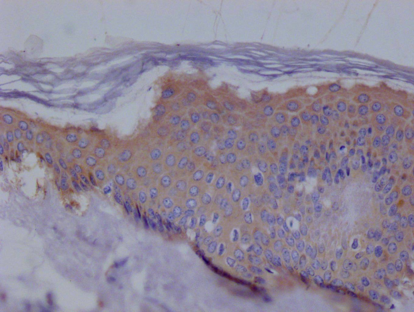 Immunohistochemistry: Ezrin Antibody (7F11) [NBP3-26596] - Image of Ezrin Antibody (7F11) diluted at 1:100 and staining in paraffin-embedded human skin tissue performed. After dewaxing and hydration, antigen retrieval was mediated by high pressure in a citrate buffer (pH 6.0). Section was blocked with 10% normal goat serum 30min at RT. Then primary antibody (1% BSA) was incubated at 4°C overnight. The primary is detected by a Goat anti-rabbit polymer IgG labeled by HRP and visualized using 0.05% DAB.