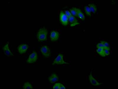 Immunocytochemistry/Immunofluorescence: ErbB3/Her3 Antibody (6F6) [NBP3-26599] - Staining of MCF7 Cells with ErbB3/Her3 Antibody (6F6) at 1:50, counter-stained with DAPI. The cells were fixed in 4% formaldehyde and blocked in 10% normal Goat Serum. The cells were then incubated with the antibody overnight at 4C. Nuclear DNA was labeled in blue with DAPI. The secondary antibody was FITC-conjugated Goat Anti-Rabbit IgG (H+L).
