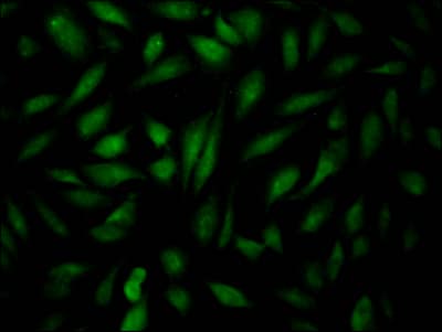 Immunocytochemistry/Immunofluorescence: HIF-2 alpha/EPAS1 Antibody (6A9) [NBP3-26600] - Staining of Hela Cells with HIF-2 alpha/EPAS1 Antibody (6A9) at 1:50, counter-stained with DAPI. The cells were fixed in 4% formaldehyde, permeated by 0.2% Triton X-100, and blocked in 10% normal Goat Serum. The cells were then incubated with the antibody overnight at 4C. Nuclear DNA was labeled in blue with DAPI. The secondary antibody was FITC-conjugated Goat Anti-Rabbit IgG (H+L).