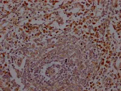 Immunohistochemistry: Neutrophil Elastase/ELA2 Antibody (2H12) [NBP3-26603] - Image of Neutrophil Elastase/ELA2 Antibody (2H12) diluted at 1:100 and staining in paraffin-embedded human spleen tissue performed. After dewaxing and hydration, antigen retrieval was mediated by high pressure in a citrate buffer (pH 6.0). Section was blocked with 10% normal goat serum 30min at RT. Then primary antibody (1% BSA) was incubated at 4C overnight. The primary is detected by a Goat anti-rabbit IgG polymer labeled by HRP and visualized using 0.05% DAB.