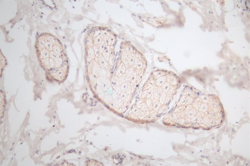 Immunohistochemistry: EGF Antibody (18B12) [NBP3-26606] - Image of EGF Antibody (18B12) diluted at 1:100 and staining in paraffin-embedded human skin tissue performed. After dewaxing and hydration, antigen retrieval was mediated by high pressure in a citrate buffer (pH 6.0). Section was blocked with 10% normal goat serum 30min at RT. Then primary antibody (1% BSA) was incubated at 4C overnight. The primary is detected by a Goat anti-rabbit polymer IgG labeled by HRP and visualized using 0.66% DAB.