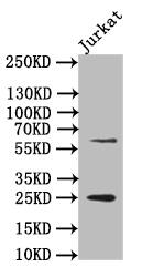 Western Blot: EBI3 Antibody (12H5) [NBP3-26607] - Positive Western Blot detected in: JK whole cell lysate. All lanes: EBI3 Antibody at 1: 500 Secondary: Goat polyclonal to rabbit IgG at 1/50000 dilution. Predicted band size: 25 kDa Observed band size: 25 kDa