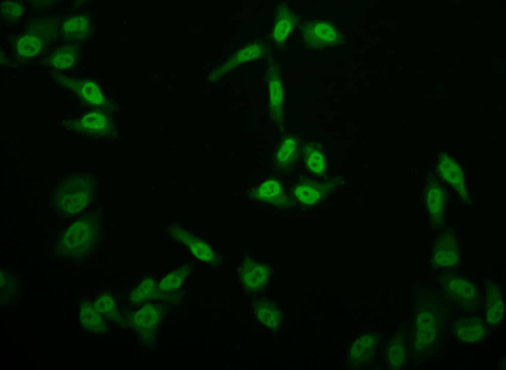 Immunocytochemistry/Immunofluorescence: E2F-4 Antibody (24E12) [NBP3-26608] -Immunofluorescence staining of Hela cell with E2F-4 Antibody at 1:50, counter-stained with DAPI. The cells were fixed in 4% formaldehyde and blocked in 10% normal Goat Serum. The cells were then incubated with the antibody overnight at 4°C. The secondary antibody was Alexa Fluor 513-congugated AffiniPure Goat Anti-Rabbit IgG(H+L).