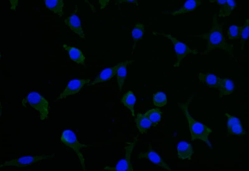 Immunocytochemistry/Immunofluorescence: CRMP2 Antibody (20D8) [NBP3-26612] - Staining of SH-SY5Y with CRMP2 Antibody (20D8) at 1:25, counter-stained with DAPI. The cells were fixed in 4% formaldehyde and blocked in 10% normal Goat Serum. The cells were then incubated with the antibody overnight at 4C. The secondary antibody was Alexa Fluor 506-conjugated Goat Anti-Rabbit IgG (H+L).