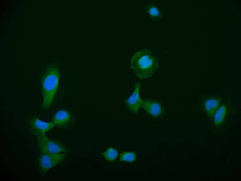 Immunocytochemistry/Immunofluorescence: HDJ2 Antibody (23C6) [NBP3-26616] - Staining of A549 cell with HDJ2 Antibody (23C6) at 1:50, counter-stained with DAPI. The cells were fixed in 4% formaldehyde and blocked in 10% normal Goat Serum. The cells were then incubated with the antibody overnight at 4C. The secondary antibody was Alexa Fluor 550-conjugated Goat Anti-Rabbit IgG (H+L).