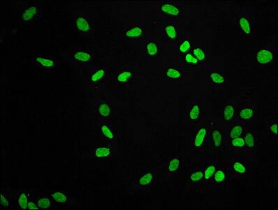 Immunocytochemistry/Immunofluorescence: Histone H3.1 [Dimethyl Lys9] Antibody (1A10) [NBP3-26621] - Staining of Hela cells with Histone H3.1 [Dimethyl Lys9] Antibody (1A10) at 1:56, counter-stained with DAPI. The cells were fixed in 4% formaldehyde, permeabilized using 0.2% Triton X-100 and blocked in 10% normal Goat Serum. The cells were then incubated with the antibody overnight at 4C. The secondary antibody was Alexa Fluor 488-conjugated Goat Anti-Rabbit IgG (H+L).