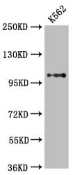 Western Blot: DGCR8 Antibody (2H2) [NBP3-26623] - Positive Western Blot detected in: K562 whole cell lysate. All lanes: DGCR8 Antibody at 2.65ug/ml. Secondary: Goat polyclonal to rabbit IgG at 1/50000 dilution. Predicted band size: 87, 33, 83 KDa Observed band size: 100 KDa