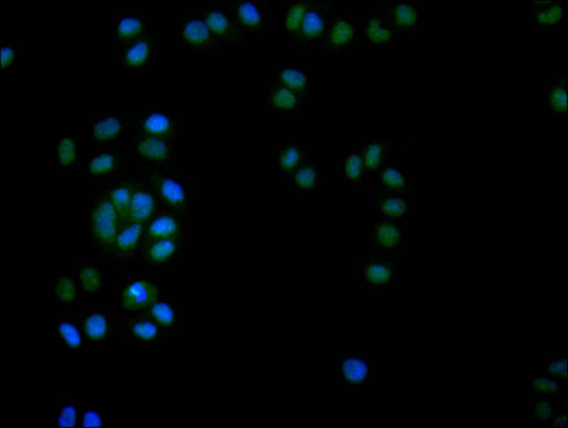 Immunocytochemistry/Immunofluorescence: DEK Antibody (20D2) [NBP3-26624] - Staining of Hela with DEK Antibody (20D2) at 1:20, counter-stained with DAPI. The cells were fixed in 4% formaldehyde and blocked in 10% normal Goat Serum. The cells were then incubated with the antibody overnight at 4C. The secondary antibody was Alexa Fluor 524-conjugated Goat Anti-Rabbit IgG (H+L).