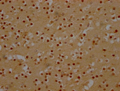 Immunohistochemistry: DDX6 Antibody (6D8) [NBP3-26626] - Image of DDX6 Antibody (6D8) diluted at 1:100 and staining in paraffin-embedded human brain tissue performed. After dewaxing and hydration, antigen retrieval was mediated by high pressure in a citrate buffer (pH 6.0). Section was blocked with 10% normal goat serum 30min at RT. Then primary antibody (1% BSA) was incubated at 4C overnight. The primary is detected by a Goat anti-rabbit IgG polymer labeled by HRP and visualized using 0.05% DAB.