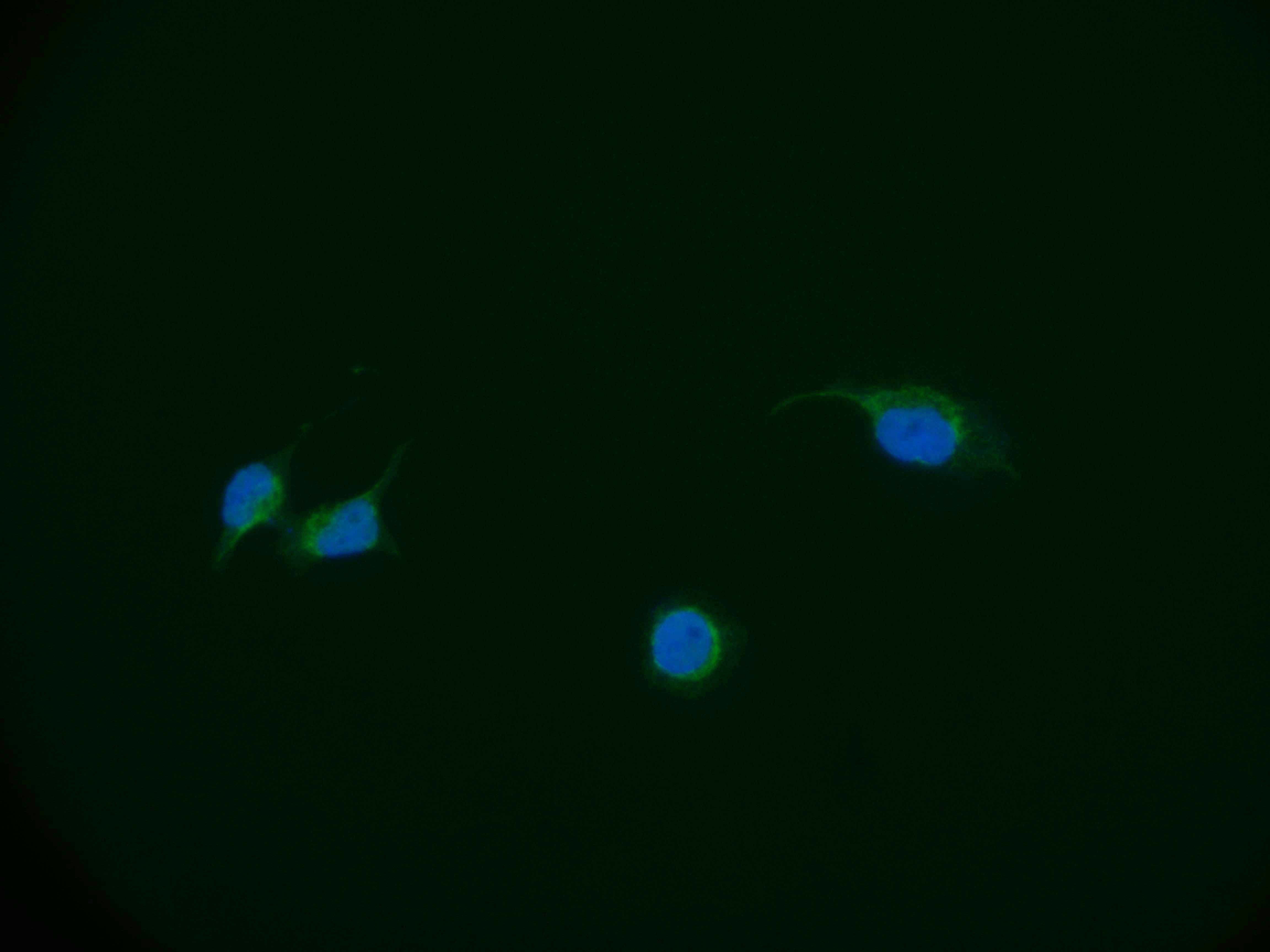 Immunocytochemistry/Immunofluorescence: DBF4 Antibody (24D8) [NBP3-26632] - Staining of A549 cell with DBF4 Antibody (24D8) at 1:50, counter-stained with DAPI. The cells were fixed in 4% formaldehyde and blocked in 10% normal Goat Serum. The cells were then incubated with the antibody overnight at 4C. The secondary antibody was Alexa Fluor 551-conjugated Goat Anti-Rabbit IgG (H+L).