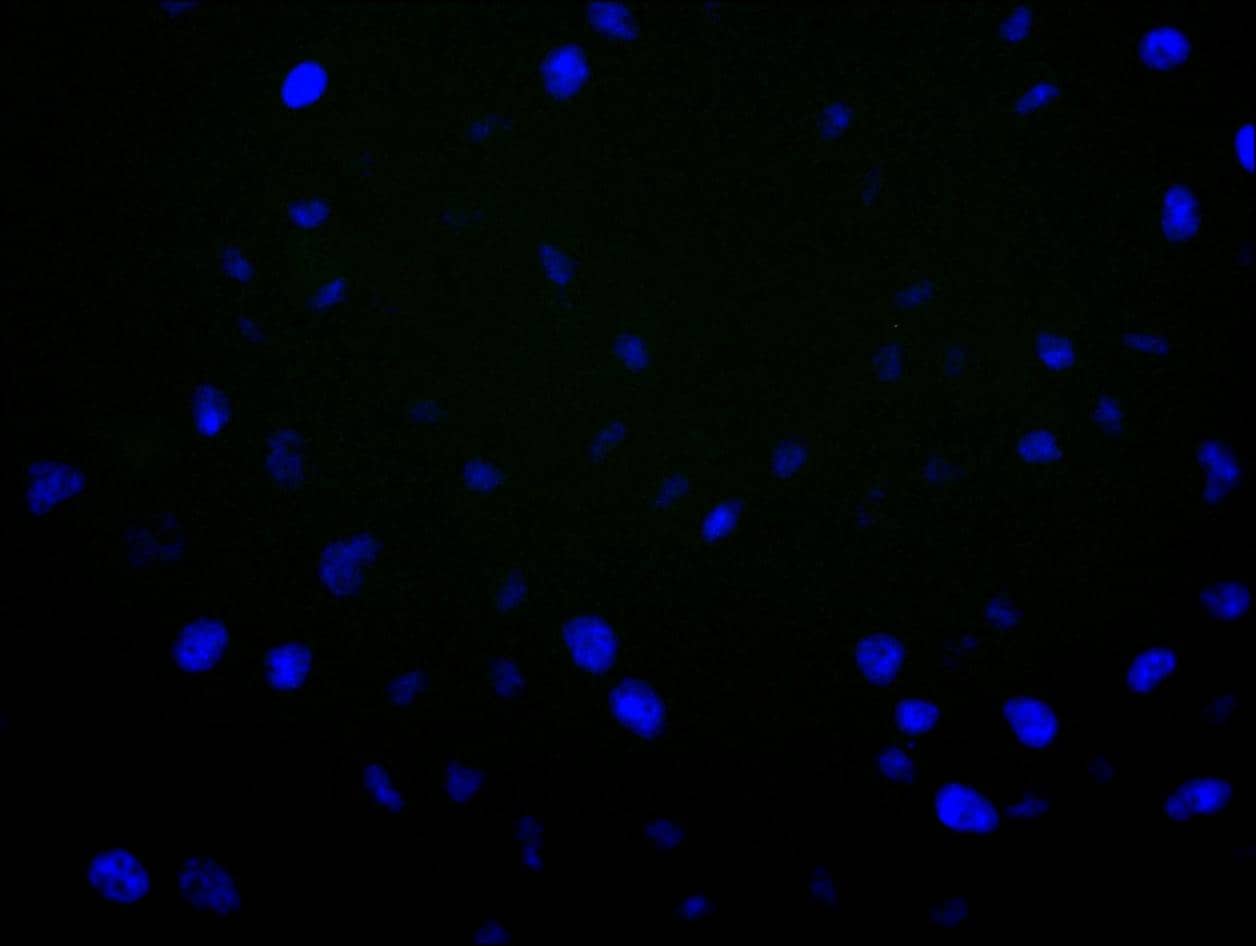 Immunocytochemistry/Immunofluorescence: Aromatase Antibody (1H1) [NBP3-26636] - Staining of Hela cell with 5% goat serum, counter-stained with DAPI. The cells were fixed in 4% formaldehyde and blocked in 10% normal Goat Serum. The cells were then incubated with the antibody overnight at 4C. The secondary antibody was Alexa Fluor 488-congugated AffiniPure Goat Anti-Rabbit IgG (H+L).