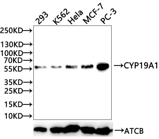 Western Blot: Aromatase Antibody (1H1) [NBP3-26636] - Positive WB detected in: 293 whole cell lysate (20µg), K562 whole cell lysate (20µg),  Hela whole cell lysate (20µg), MCF-7 whole cell lysate (20µg), PC-3 whole cell lysate (20µg)All lanes: CYP19A1 antibody at 1:1000SecondaryGoat polyclonal to rabbit IgG at 1/50000 dilutionPredicted band size: 58 kDaObserved band size: 58 kDaExposure time：120s