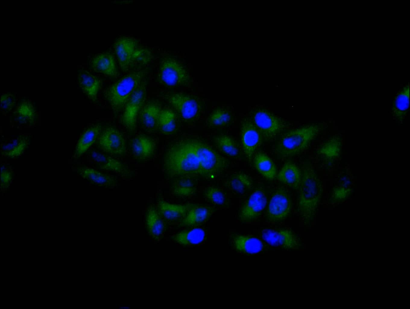 Immunocytochemistry/Immunofluorescence: Aromatase Antibody (1H1) [NBP3-26636] - Staining of Hela cell with NBP3-26636 at 1:50, counter-stained with DAPI. The cells were fixed in 4% formaldehyde and blocked in 10% normal Goat Serum. The cells were then incubated with the antibody overnight at 4C. The secondary antibody was Alexa Fluor 488-congugated AffiniPure Goat Anti-Rabbit IgG (H+L).