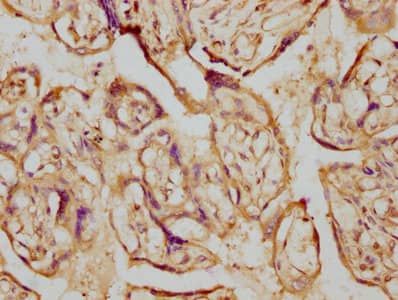 Immunohistochemistry Aromatase Antibody (1H1)