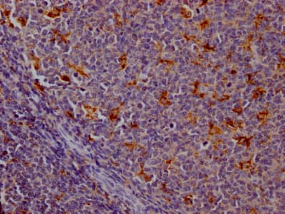 Immunohistochemistry: Cathepsin S Antibody (9B10) [NBP3-26639] - Image of Cathepsin S Antibody (9B10) diluted at 1:100 and staining in paraffin-embedded human tonsil tissue performed. After dewaxing and hydration, antigen retrieval was mediated by high pressure in a citrate buffer (pH 6.0). Section was blocked with 10% normal goat serum 30min at RT. Then primary antibody (1% BSA) was incubated at 4C overnight. The primary is detected by a Goat anti-rabbit IgG polymer labeled by HRP and visualized using 0.05% DAB.