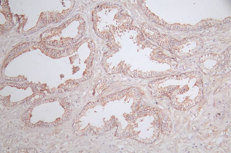 Immunohistochemistry: Claudin-5 Antibody (13G6) [NBP3-26652] - Image of Claudin-5 Antibody (13G6) diluted at 1:100 and staining in paraffin-embedded human prostate tissue performed. After dewaxing and hydration, antigen retrieval was mediated by high pressure in a citrate buffer (pH 6.0). Section was blocked with 10% normal goat serum 30min at RT. Then primary antibody (1% BSA) was incubated at 4°C overnight. The primary is detected by a Goat anti-rabbit polymer IgG labeled by HRP and visualized using 0.77% DAB.