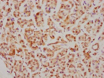 Immunohistochemistry: CDC5L Antibody (1E3) [NBP3-26668] - Image of CDC5L Antibody (1E3) diluted at 1:126.5 and staining in paraffin-embedded human appendix tissue performed. After dewaxing and hydration, antigen retrieval was mediated by high pressure in a citrate buffer (pH 6.0). Section was blocked with 10% normal goat serum 30min at RT. Then primary antibody (1% BSA) was incubated at 4C overnight. The primary is detected by a biotinylated secondary antibody and visualized using an HRP conjugated SP system.